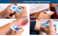 1 x RAW Customer Returns EMAY Bluetooth Portable ECG EKG Monitor for iPhone Android, Mac Windows Wireless Personal ECG Monitor Works with Smartphones Records Rhythm Heart Rate, Gives Instant Detections EMG-20  - RRP £87.9